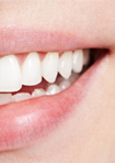 Ultra-white teeth